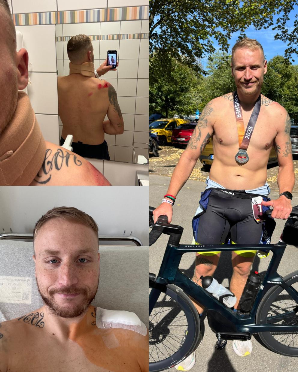 Collage aus drei Bildern von Amateuertriathlet mit Verletzungen