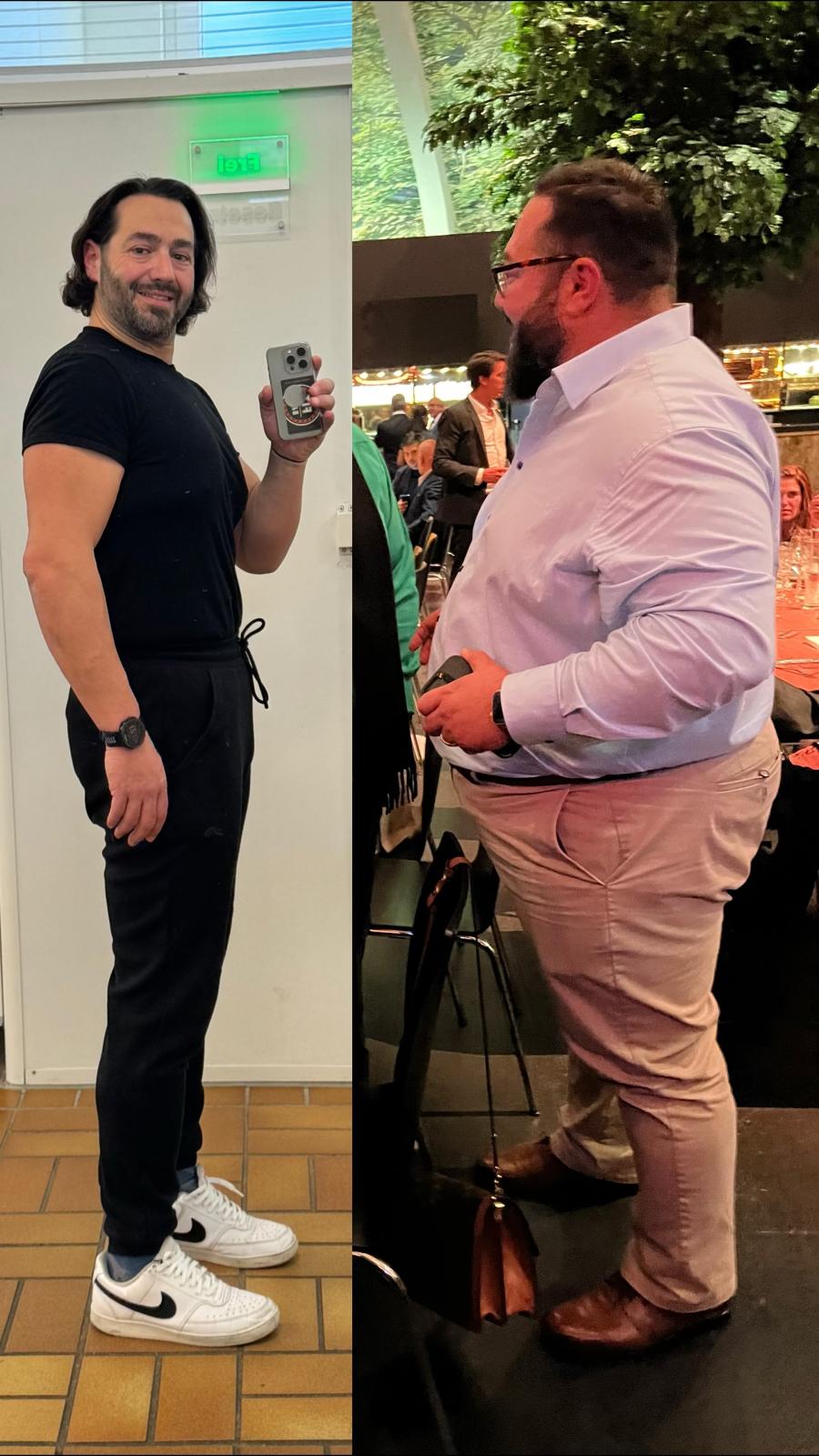 Vergleich von zwei Fotos mit auffallender Gewichtsabnahme